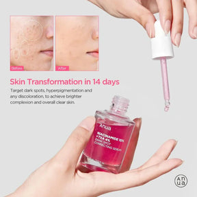 anua serum

anua niacinamida 10% txa 4% dark spot correcting serum

ANUA - Sérum Corretor de Manchas Dark Sp