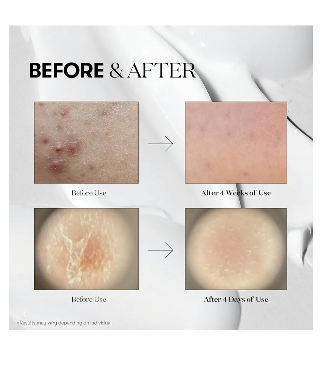 VT COSMETICS - Reedle Shot (50/100/300/700 Microagulhas) - Sérum Revitalizante e Hidratante CICA 50ml